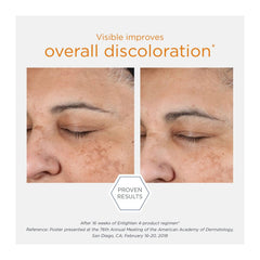 Before and after comparison of skin discoloration improvement with text indicating proven results.