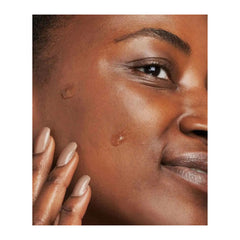 Close-up of a woman's face with visible skin blemishes, using a hand to touch her cheek.